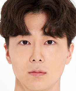 눈·코·무턱보형물 수술 후 3개월 정면