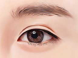 눈매 일러스트 — 수술 후 눈이 더 작아 보이는 경우