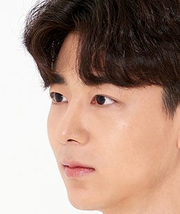 눈·코·무턱보형물 수술 후 3개월 45도