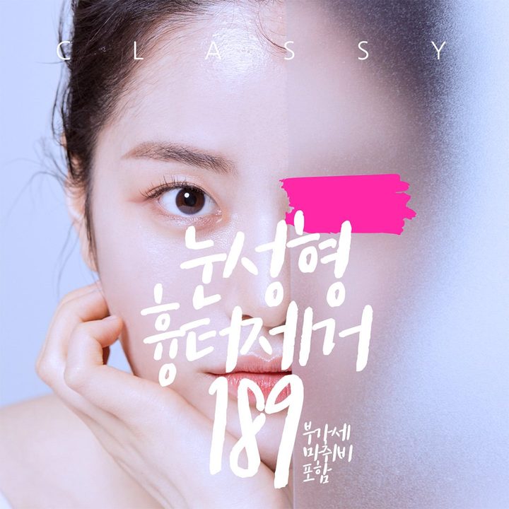 눈성형 흉터제거 189 부가세 마취비 포함 — 한쪽 눈 모델
